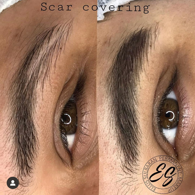 SIGNATURE SCAR